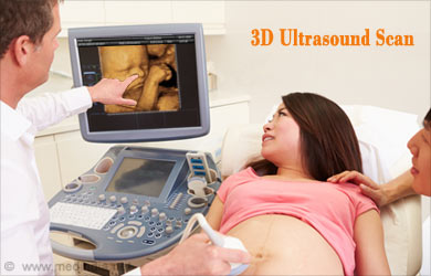 Pregnancy Ultrasound