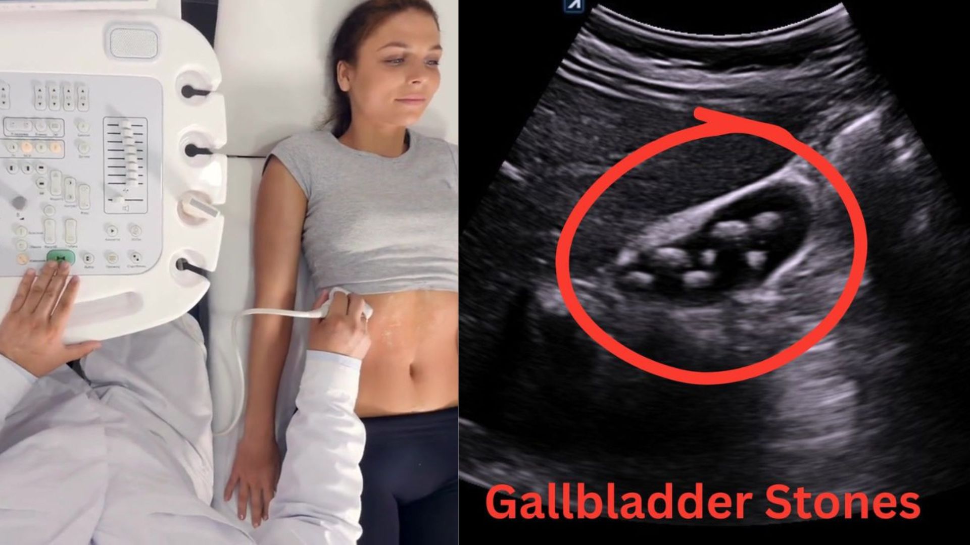 Abdominal Ultrasound