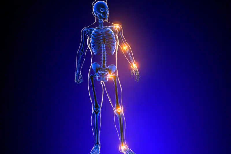 Musculoskeletal/Joints Scan